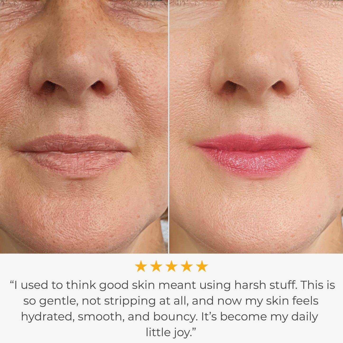 TXA+Niacinamide Glow Reset Kit