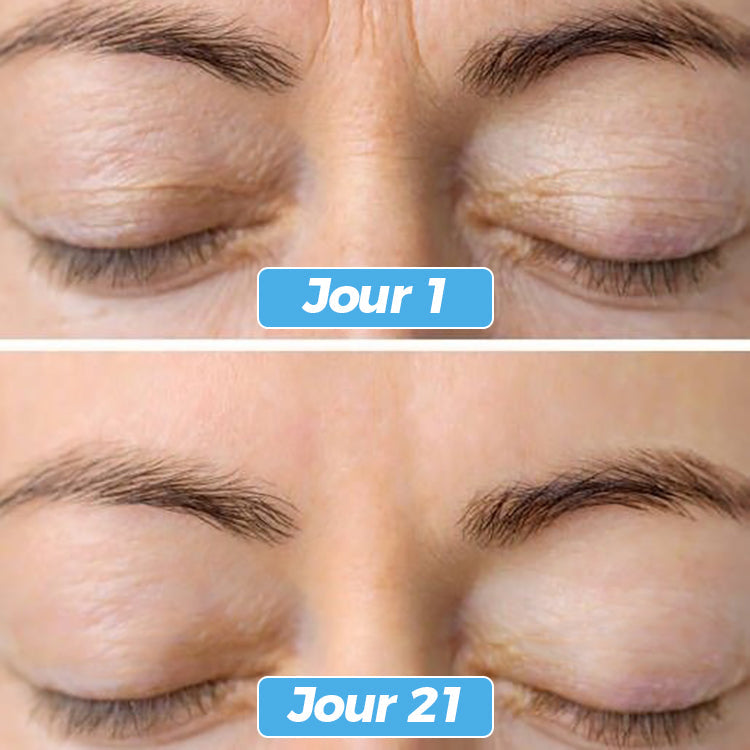 Glowskin Pro® – Masque LED Soin Visage & Cou