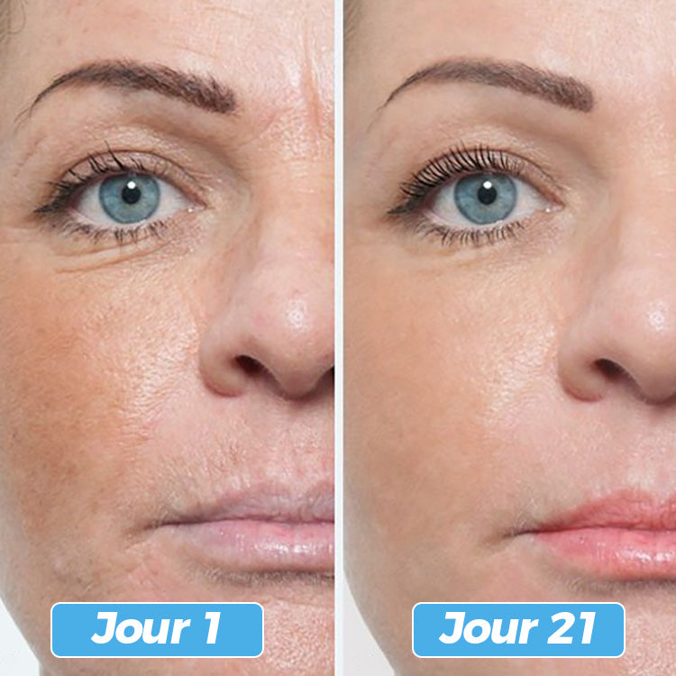 Glowskin Pro® – Masque LED Soin Visage & Cou