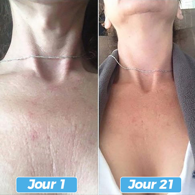 Glowskin Pro® – Masque LED Soin Visage & Cou